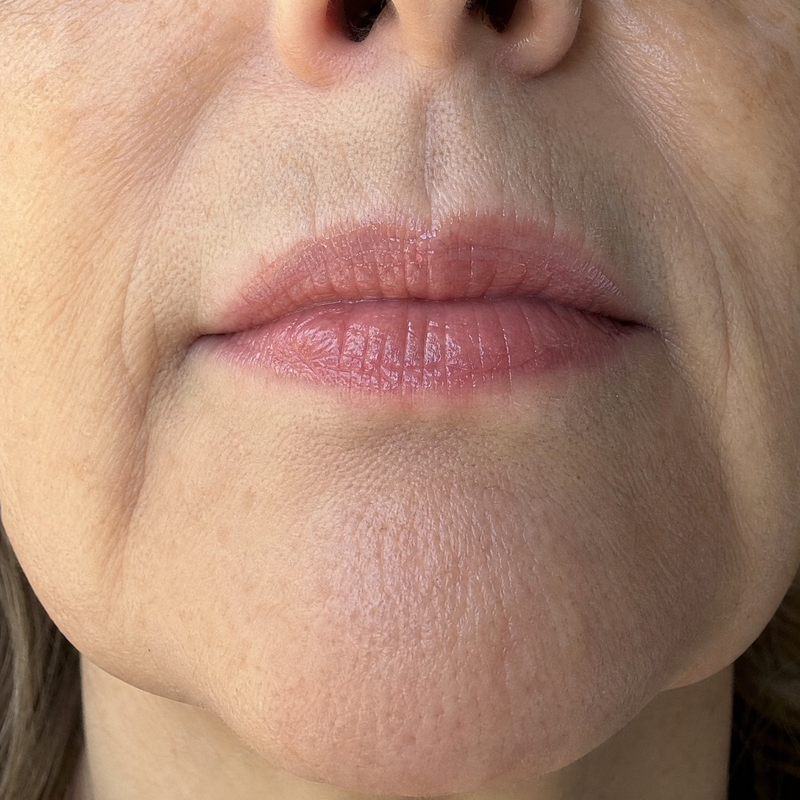 grid 5 lips
