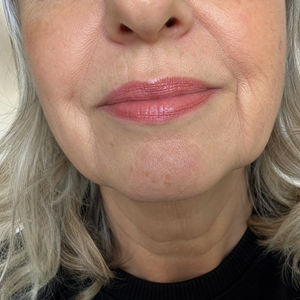 rev lips 1