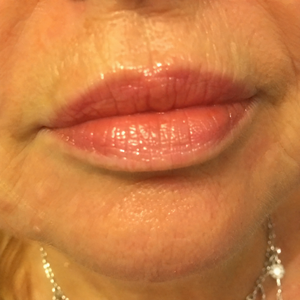 rev lips 2